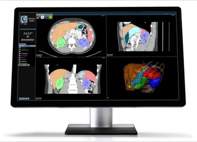 F.A.S.T.® AI Annotation - Fovia Ai provides its customers with AI-assisted annotation, powered by the NVIDIA Clara SDK, in its tools for 2D and 3D visualization of medical images, which can seamlessly integrate into the clinical workflow.