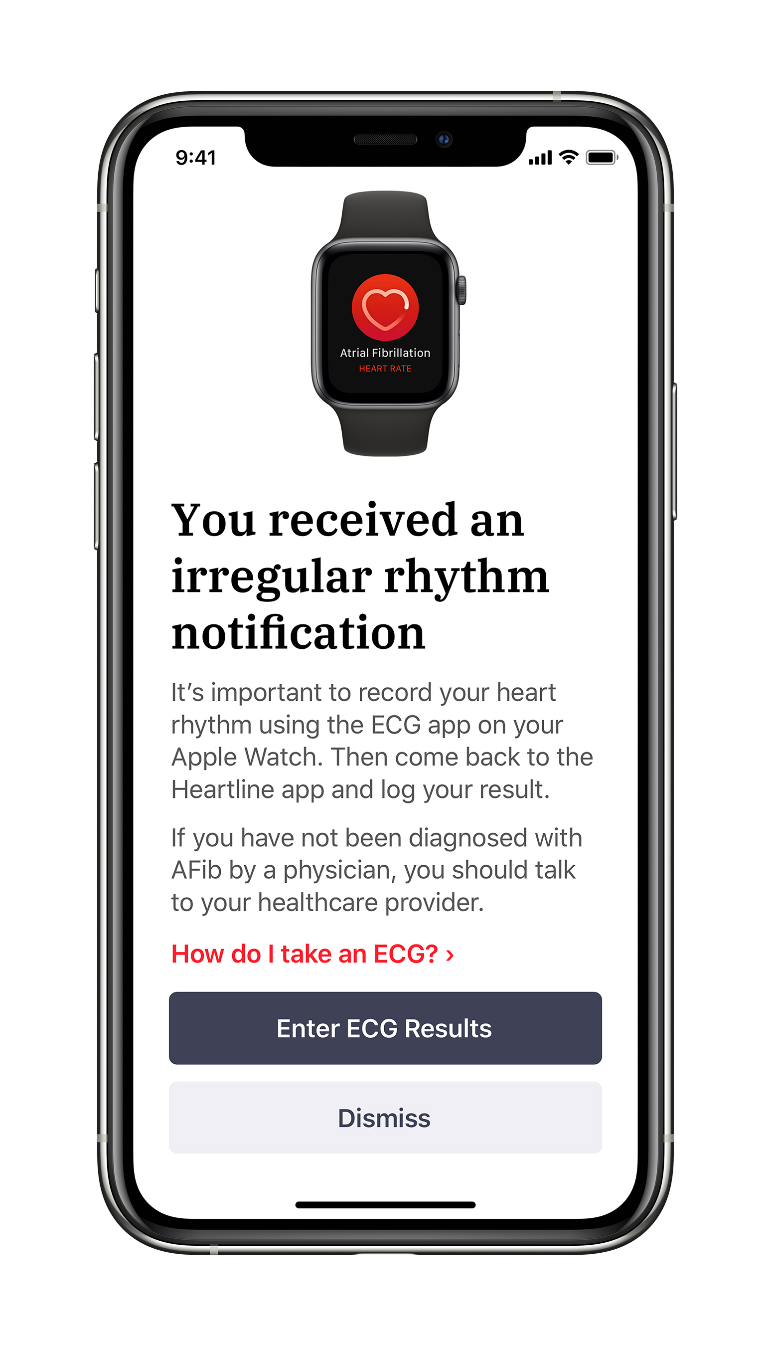 If a study participant in the watch-wearing study arm receives an irregular rhythm notification, they will be prompted through the Heartline™ Study app to complete an ECG on their Apple Watch.