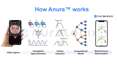 Contactless measurement is made possible through NuraLogix’s patented Transdermal Optical Imaging (TOI™) technology and global clinical research studies to improve and verify the algorithm and accuracy