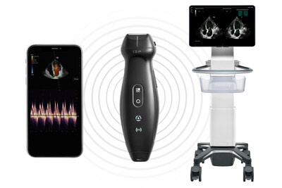 The TE Air is the industry’s first handheld ultrasound device that can connect to either a mobile device or the touch-based TE X Ultrasound System, expanding its utility and accessibility.