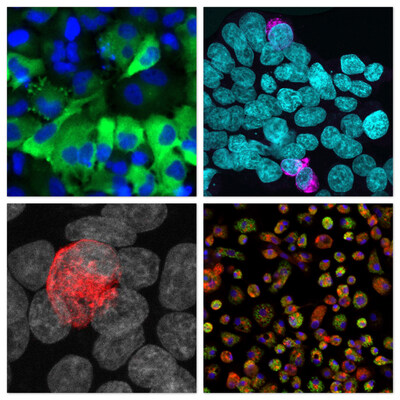 Top left: The nuclei of human cells appear in blue. The green signal indicates the presence of a dengue virus protein.
Top right: The nuclei of human cells appear in teal. The magenta signal indicates the presence of a dengue virus protein.
Bottom left: The nuclei of human cells appear in grey. The red signal indicates the presence of a dengue virus protein.
Bottom right: The nuclei of mosquito cells appear in blue. The red and green signal indicates the presence of two dengue virus proteins.