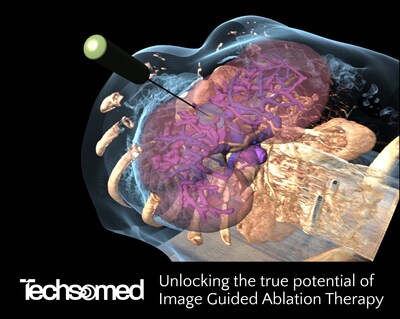 Techsomed Launches BioTraceIO Suite: FDA-Cleared Image-Guided Ablation Therapy Software Solutions that Provide Physicians with Personalized Treatment Planning and Assessment Tools, Including Predictive Insights on Post-Ablation Tissue Damage to Enhance Accuracy and Efficiency in Liver Tumor Ablation