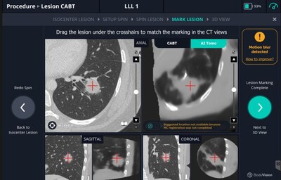 Revised AI Tomo® with larger field of view.