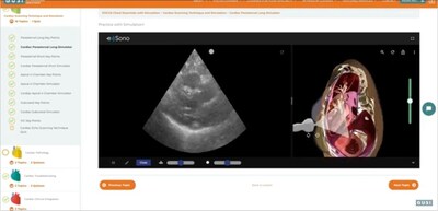 GUSI's award-winning online POCUS training course plus Simulation powered by e Sono