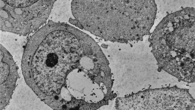 A new study from Cold Spring Harbor Laboratory Professor Lloyd Trotman and colleagues, published in Science, shows that menadione significantly slows prostate cancer growth in mice and in human-derived cancer cells, as seen here.