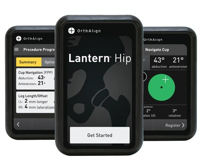 Lantern® Hip