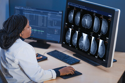 Sectra's module for breast imaging