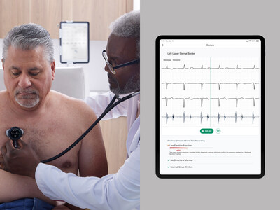 Code paves the way for reimbursement and expanded clinical use of AI-enabled heart disease detection.