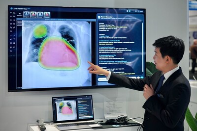 A Lunit representative demonstrates the Autonomous Chest X-Ray Report Generation prototype to booth visitors at RSNA 2024, showcasing how AI-driven automation is transforming diagnostic workflows. (Courtesy of Lunit)