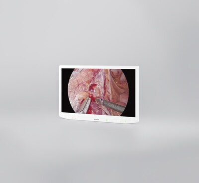 32-inch 4K 2D mini LED surgical monitor featuring Sony’s Advanced Local Dimming Technology