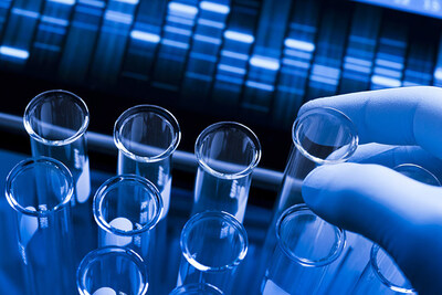 New Analytical Validation Confirms Accuracy and Precision of MyProstateScore 2.0