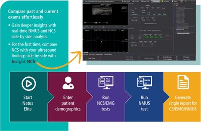 Combining InVisus Pro with Natus Elite makes it simple for doctors and clinicians to compare current and past exams to gain deeper insights. This includes side-by-side, real-time analysis of NMUS and nerve conduction studies (NCS). Infographic: NMUS Integration workflow and Insight NCS
