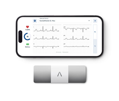 KardiaMobile 6L Max is powered by advanced AI to offer a wider range of arrhythmia detection.