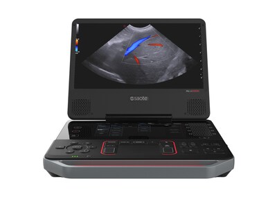 The new MyLab™Heron ultrasound scanner The new MyLab™Heron ultrasound scanner