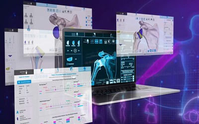 Exactech unveils its next-generation Shoulder Planning App, designed to improve surgical precision and simplify shoulder replacement planning.