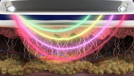 Cannot view this image? Visit: https://healthtechnologynet.com/wp-content/uploads/2025/06/256006_a0a5a976c45daa00_002.jpg