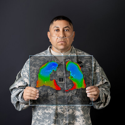 Veteran with biopsy-confirmed constrictive bronchiolitis, holds XV LVAS® color-mapped image of his lungs. Veteran with biopsy-confirmed constrictive bronchiolitis, holds XV LVAS® color-mapped image of his lungs.