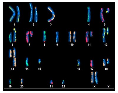 This image shows chromosomes in the pancreatic cancer cell line, where mixed colors indicate chromosomal rearrangements. For example, the first copy of chromosome 1 in the top left of the image is normal because both the top and bottom are yellow, but the top part of the second copy of chromosome 1 is replaced by the top part of chromosome 2 (blue) due to a rearrangement of chromosomes in the tumor. Image was created using the Kromatid KROMASURE Screen platform.

Credit: NIST