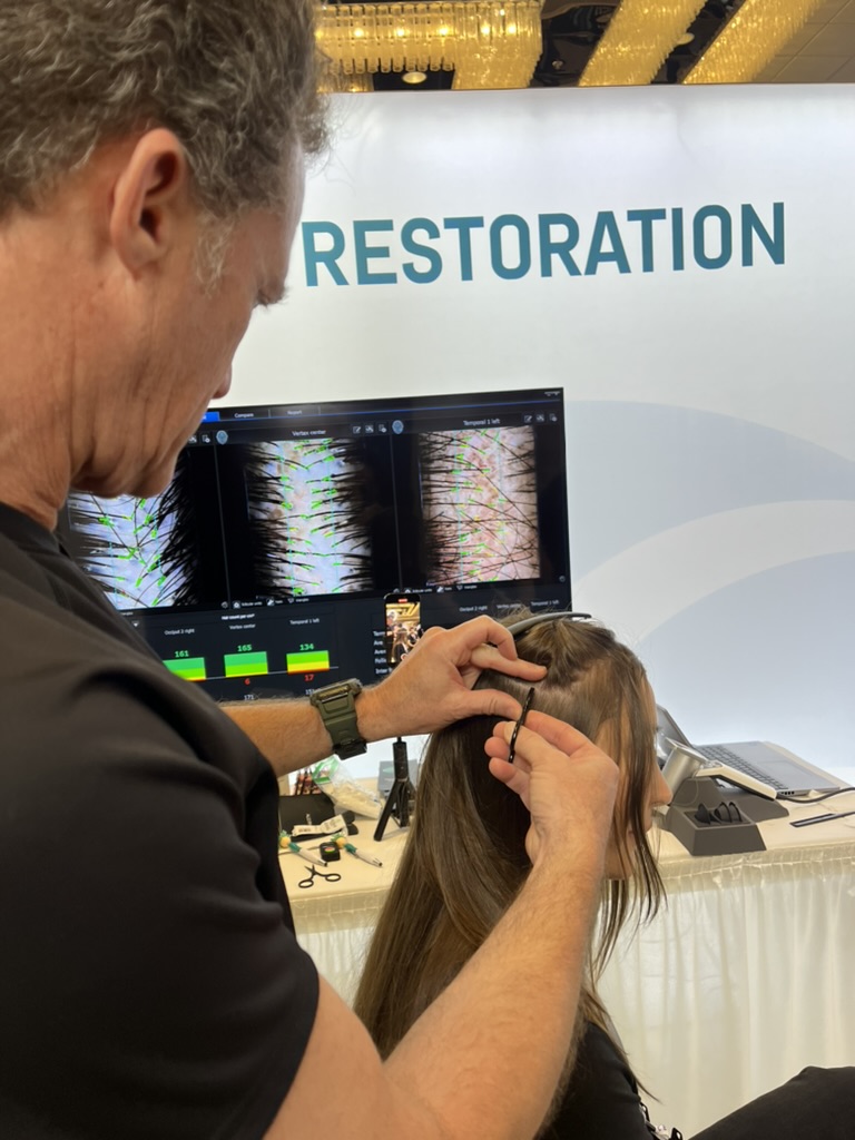 Hair Follicle Stem Cell Banking