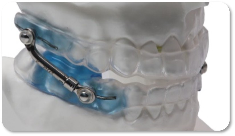 Vivos Therapeutics, Inc