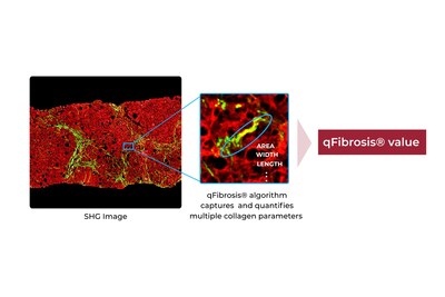 Quantifying multiple collagen parameters with qFibrosis® Quantifying multiple collagen parameters with qFibrosis®