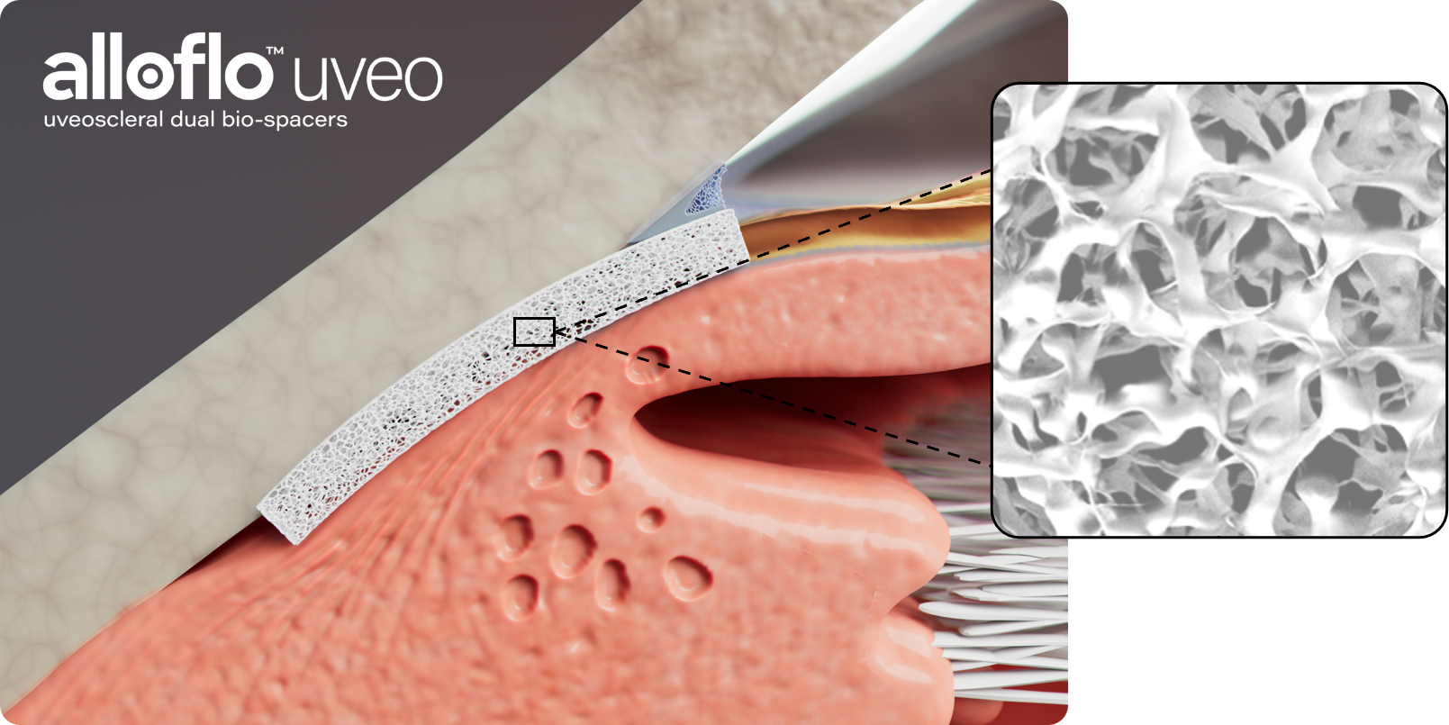 AlloFlo Uveo Branded Image