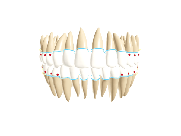 3D AI-Generated Mouth Model