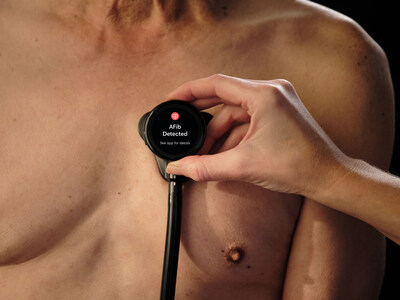 Landmark TRICORDER study finds major gains in detection of heart failure, atrial fibrillation, and valvular disease with Eko Health’s AI-enabled stethoscopes in routine exams.