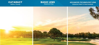 Advanced Technology Lens