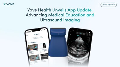 Vave Health Unveils App Update, Advancing Medical Education and Ultrasound Imaging. New release introduces VaveEdTM, enhanced image quality, and new tools to support obstetric workflows