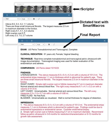 rScriptor SmartMacros