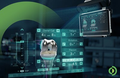 GPS Knee empowers surgeons with the Newton Balancing technique, delivering dynamic soft tissue analytics and personalized planning for reproducible, balanced total knee replacement surgery. GPS Knee empowers surgeons with the Newton Balancing technique, delivering dynamic soft tissue analytics and personalized planning for reproducible, balanced total knee replacement surgery.