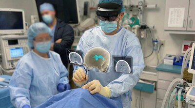 Third-person view Third-person view