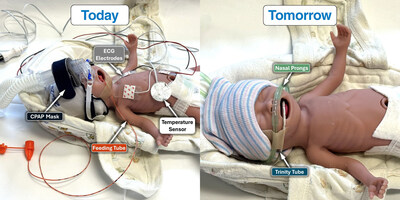 Before and after the use of the Trinity Tube.