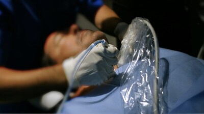 STARmed Thyroid Radiofrequency Ablation (RFA) STARmed Thyroid Radiofrequency Ablation (RFA)