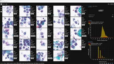 Urinary Citology Urinary Citology