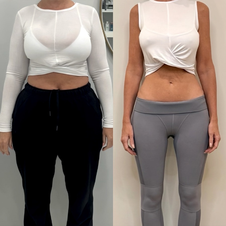 BODYWELLE brings established experience with physician-supervised GLP-1 therapy, with over 127 satisfied patients.