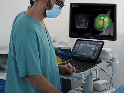 Prostate Attention Map (PAM), Esaote&rsquo;s new innovative technology dedicated to urology. (PRNewsfoto/Esaote S.p.A)