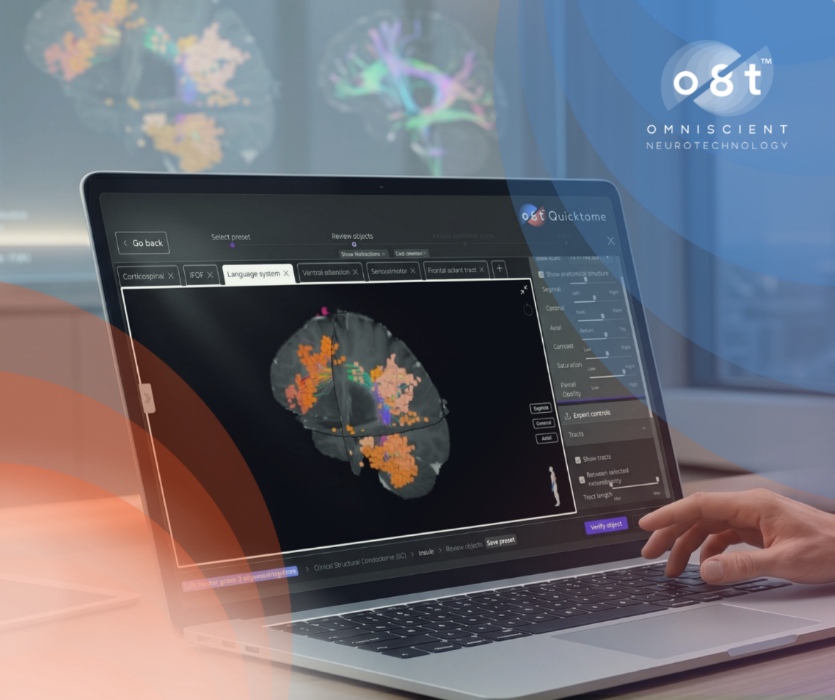 A laptop screen displaying a connectomic brain map powered by Omniscient's technology.