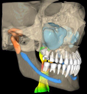 3D Image 3 3D Image 3