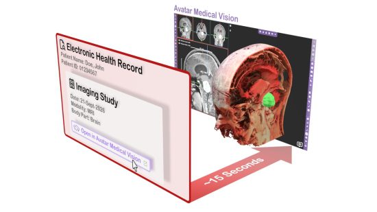 Cannot view this image? Visit: https://healthtechnologynet.com/wp-content/uploads/2026/10/316951_figure1_550.jpg